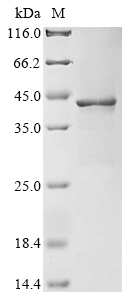 (Tris-Glycine gel) Discontinuous SDS-PAGE (reduced) with 5% enrichment gel and 15% separation gel. (Tris-Glycine gel) Discontinuous SDS-PAGE (reduced) with 5% enrichment gel and 15% separation gel.