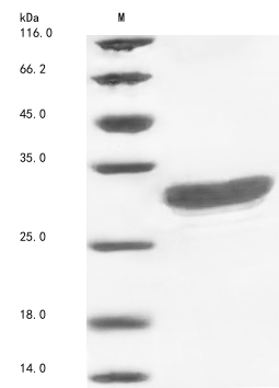 (Tris-Glycine gel) Discontinuous SDS-PAGE (reduced) with 5% enrichment gel and 15% separation gel. (Tris-Glycine gel) Discontinuous SDS-PAGE (reduced) with 5% enrichment gel and 15% separation gel.