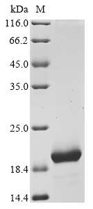 Recombinant Chicken Avidin (AVD) - image 1