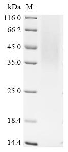 Recombinant Simian retrovirus SRV-1 Envelope glycoprotein (env) , partial - image 1