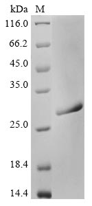 (Tris-Glycine gel) Discontinuous SDS-PAGE (reduced) with 5% enrichment gel and 15% separation gel. (Tris-Glycine gel) Discontinuous SDS-PAGE (reduced) with 5% enrichment gel and 15% separation gel.