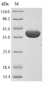 (Tris-Glycine gel) Discontinuous SDS-PAGE (reduced) with 5% enrichment gel and 15% separation gel. (Tris-Glycine gel) Discontinuous SDS-PAGE (reduced) with 5% enrichment gel and 15% separation gel.