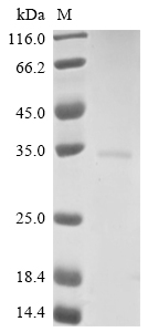 (Tris-Glycine gel) Discontinuous SDS-PAGE (reduced) with 5% enrichment gel and 15% separation gel. (Tris-Glycine gel) Discontinuous SDS-PAGE (reduced) with 5% enrichment gel and 15% separation gel.