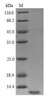 (Tris-Glycine gel) Discontinuous SDS-PAGE (reduced) with 5% enrichment gel and 15% separation gel. (Tris-Glycine gel) Discontinuous SDS-PAGE (reduced) with 5% enrichment gel and 15% separation gel.