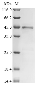 (Tris-Glycine gel) Discontinuous SDS-PAGE (reduced) with 5% enrichment gel and 15% separation gel. (Tris-Glycine gel) Discontinuous SDS-PAGE (reduced) with 5% enrichment gel and 15% separation gel.
