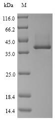 (Tris-Glycine gel) Discontinuous SDS-PAGE (reduced) with 5% enrichment gel and 15% separation gel.