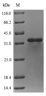 (Tris-Glycine gel) Discontinuous SDS-PAGE (reduced) with 5% enrichment gel and 15% separation gel. (Tris-Glycine gel) Discontinuous SDS-PAGE (reduced) with 5% enrichment gel and 15% separation gel.