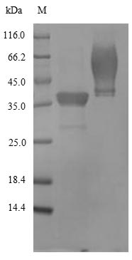 (Tris-Glycine gel) Discontinuous SDS-PAGE (reduced) with 5% enrichment gel and 15% separation gel. (Tris-Glycine gel) Discontinuous SDS-PAGE (reduced) with 5% enrichment gel and 15% separation gel.