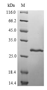 (Tris-Glycine gel) Discontinuous SDS-PAGE (reduced) with 5% enrichment gel and 15% separation gel. (Tris-Glycine gel) Discontinuous SDS-PAGE (reduced) with 5% enrichment gel and 15% separation gel.