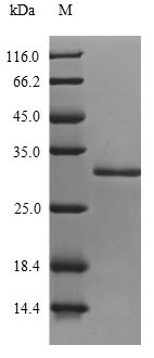 (Tris-Glycine gel) Discontinuous SDS-PAGE (reduced) with 5% enrichment gel and 15% separation gel. (Tris-Glycine gel) Discontinuous SDS-PAGE (reduced) with 5% enrichment gel and 15% separation gel.