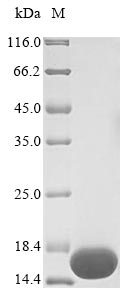 (Tris-Glycine gel) Discontinuous SDS-PAGE (reduced) with 5% enrichment gel and 15% separation gel. (Tris-Glycine gel) Discontinuous SDS-PAGE (reduced) with 5% enrichment gel and 15% separation gel.