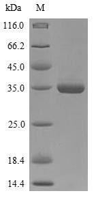 SDS-PAGE- Recombinant protein Bordetella BB3856
