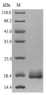 (Tris-Glycine gel) Discontinuous SDS-PAGE (reduced) with 5% enrichment gel and 15% separation gel. (Tris-Glycine gel) Discontinuous SDS-PAGE (reduced) with 5% enrichment gel and 15% separation gel.
