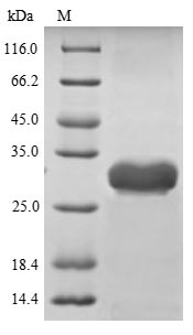 (Tris-Glycine gel) Discontinuous SDS-PAGE (reduced) with 5% enrichment gel and 15% separation gel. (Tris-Glycine gel) Discontinuous SDS-PAGE (reduced) with 5% enrichment gel and 15% separation gel.