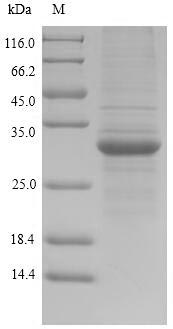(Tris-Glycine gel) Discontinuous SDS-PAGE (reduced) with 5% enrichment gel and 15% separation gel. (Tris-Glycine gel) Discontinuous SDS-PAGE (reduced) with 5% enrichment gel and 15% separation gel.