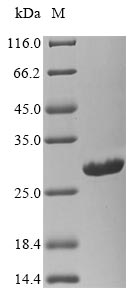 SDS-PAGE- Recombinant protein Bunyavirus N