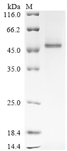 (Tris-Glycine gel) Discontinuous SDS-PAGE (reduced) with 5% enrichment gel and 15% separation gel. (Tris-Glycine gel) Discontinuous SDS-PAGE (reduced) with 5% enrichment gel and 15% separation gel.