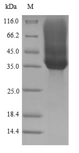 (Tris-Glycine gel) Discontinuous SDS-PAGE (reduced) with 5% enrichment gel and 15% separation gel. (Tris-Glycine gel) Discontinuous SDS-PAGE (reduced) with 5% enrichment gel and 15% separation gel.