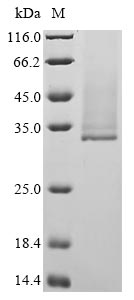 Recombinant Borrelia burgdorferi Outer surface protein A (ospA) - image 1