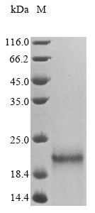 (Tris-Glycine gel) Discontinuous SDS-PAGE (reduced) with 5% enrichment gel and 15% separation gel. (Tris-Glycine gel) Discontinuous SDS-PAGE (reduced) with 5% enrichment gel and 15% separation gel.