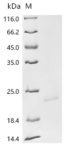 Recombinant Epstein-Barr virus Epstein-Barr nuclear antigen 1 (EBNA1) , partial - image 1