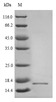 (Tris-Glycine gel) Discontinuous SDS-PAGE (reduced) with 5% enrichment gel and 15% separation gel. (Tris-Glycine gel) Discontinuous SDS-PAGE (reduced) with 5% enrichment gel and 15% separation gel.