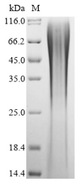 (Tris-Glycine gel) Discontinuous SDS-PAGE (reduced) with 5% enrichment gel and 15% separation gel. (Tris-Glycine gel) Discontinuous SDS-PAGE (reduced) with 5% enrichment gel and 15% separation gel.
