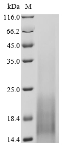 (Tris-Glycine gel) Discontinuous SDS-PAGE (reduced) with 5% enrichment gel and 15% separation gel. (Tris-Glycine gel) Discontinuous SDS-PAGE (reduced) with 5% enrichment gel and 15% separation gel.