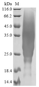 (Tris-Glycine gel) Discontinuous SDS-PAGE (reduced) with 5% enrichment gel and 15% separation gel. (Tris-Glycine gel) Discontinuous SDS-PAGE (reduced) with 5% enrichment gel and 15% separation gel.