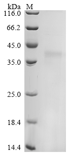 Recombinant Felis catus (Cat) Creatine kinase (CKM) , partial - image 1