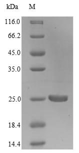 (Tris-Glycine gel) Discontinuous SDS-PAGE (reduced) with 5% enrichment gel and 15% separation gel. (Tris-Glycine gel) Discontinuous SDS-PAGE (reduced) with 5% enrichment gel and 15% separation gel.