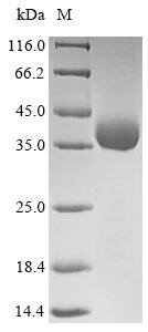 (Tris-Glycine gel) Discontinuous SDS-PAGE (reduced) with 5% enrichment gel and 15% separation gel. (Tris-Glycine gel) Discontinuous SDS-PAGE (reduced) with 5% enrichment gel and 15% separation gel.