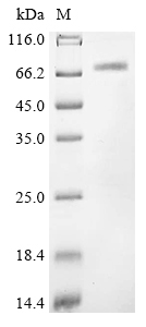 Recombinant Coxiella burnetII Hypothetical membrane spanning protein (CBU_1863) , partial - image 1