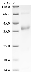 (Tris-Glycine gel) Discontinuous SDS-PAGE (reduced) with 5% enrichment gel and 15% separation gel. (Tris-Glycine gel) Discontinuous SDS-PAGE (reduced) with 5% enrichment gel and 15% separation gel.