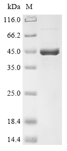 (Tris-Glycine gel) Discontinuous SDS-PAGE (reduced) with 5% enrichment gel and 15% separation gel.