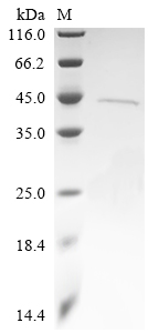 (Tris-Glycine gel) Discontinuous SDS-PAGE (reduced) with 5% enrichment gel and 15% separation gel.