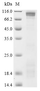 Recombinant Human cGMP-specific 3', 5'-cyclic phosphodiesterase (PDE5A) , partial - image 1