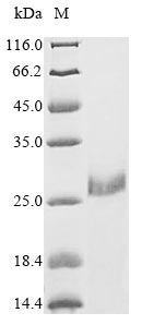 (Tris-Glycine gel) Discontinuous SDS-PAGE (reduced) with 5% enrichment gel and 15% separation gel. (Tris-Glycine gel) Discontinuous SDS-PAGE (reduced) with 5% enrichment gel and 15% separation gel.