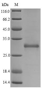 (Tris-Glycine gel) Discontinuous SDS-PAGE (reduced) with 5% enrichment gel and 15% separation gel. (Tris-Glycine gel) Discontinuous SDS-PAGE (reduced) with 5% enrichment gel and 15% separation gel.