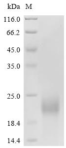 Recombinant Porcine reproductive and respiratory syndrome virus Nucleoprotein (N) - image 1