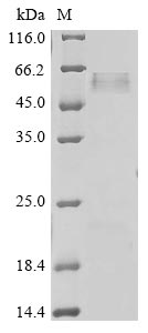 (Tris-Glycine gel) Discontinuous SDS-PAGE (reduced) with 5% enrichment gel and 15% separation gel. (Tris-Glycine gel) Discontinuous SDS-PAGE (reduced) with 5% enrichment gel and 15% separation gel.