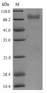 (Tris-Glycine gel) Discontinuous SDS-PAGE (reduced) with 5% enrichment gel and 15% separation gel. (Tris-Glycine gel) Discontinuous SDS-PAGE (reduced) with 5% enrichment gel and 15% separation gel.