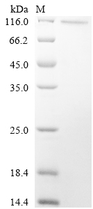 (Tris-Glycine gel) Discontinuous SDS-PAGE (reduced) with 5% enrichment gel and 15% separation gel. (Tris-Glycine gel) Discontinuous SDS-PAGE (reduced) with 5% enrichment gel and 15% separation gel.