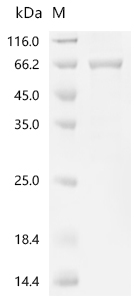 Recombinant Human Myotubularin (MTM1) - image 1