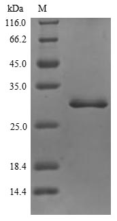 (Tris-Glycine gel) Discontinuous SDS-PAGE (reduced) with 5% enrichment gel and 15% separation gel. (Tris-Glycine gel) Discontinuous SDS-PAGE (reduced) with 5% enrichment gel and 15% separation gel.