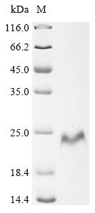 Recombinant Human Laminin subunit gamma-2 (LAMC2) , partial - image 1
