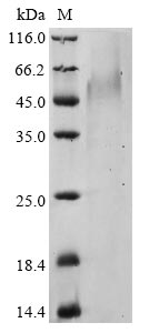 (Tris-Glycine gel) Discontinuous SDS-PAGE (reduced) with 5% enrichment gel and 15% separation gel. (Tris-Glycine gel) Discontinuous SDS-PAGE (reduced) with 5% enrichment gel and 15% separation gel.