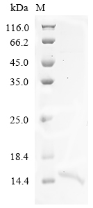 (Tris-Glycine gel) Discontinuous SDS-PAGE (reduced) with 5% enrichment gel and 15% separation gel. (Tris-Glycine gel) Discontinuous SDS-PAGE (reduced) with 5% enrichment gel and 15% separation gel.