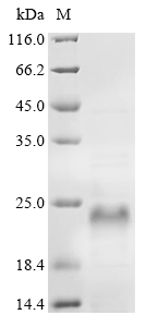 (Tris-Glycine gel) Discontinuous SDS-PAGE (reduced) with 5% enrichment gel and 15% separation gel. (Tris-Glycine gel) Discontinuous SDS-PAGE (reduced) with 5% enrichment gel and 15% separation gel.