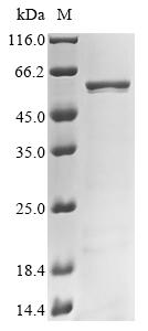 Recombinant Human Retinoid isomerohydrolase (RPE65) - image 1